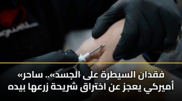 «فقدان السيطرة على الجسد».. ساحر أميركي يعجز عن اختراق شريحة زرعها بيده