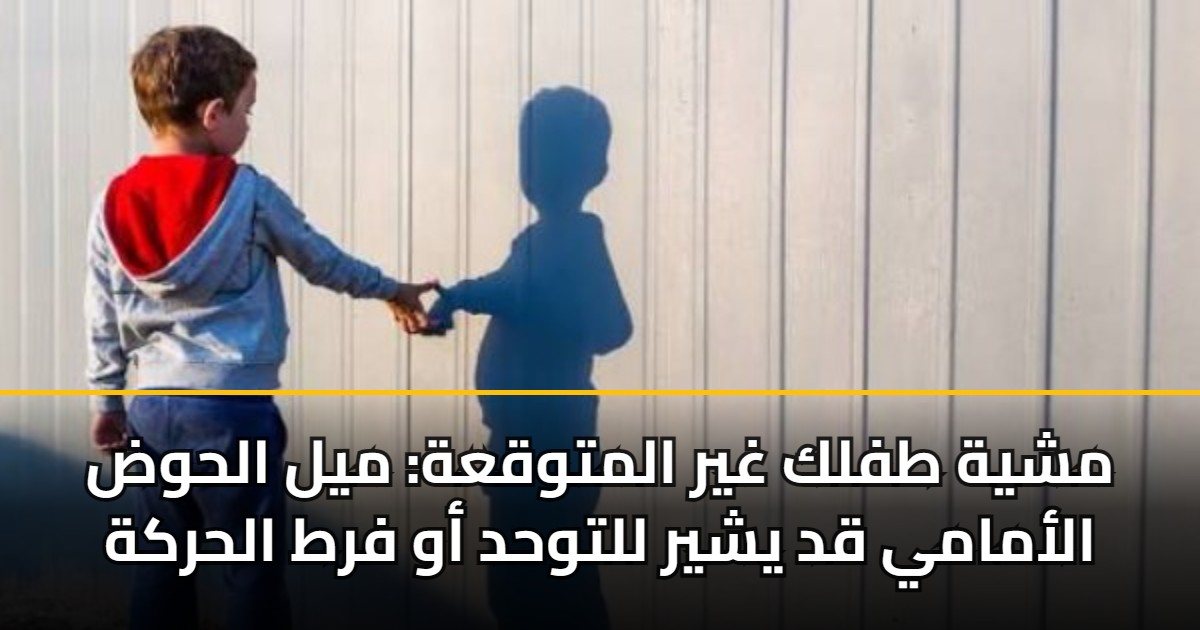 مشية طفلك غير المتوقعة: ميل الحوض الأمامي قد يشير للتوحد أو فرط الحركة