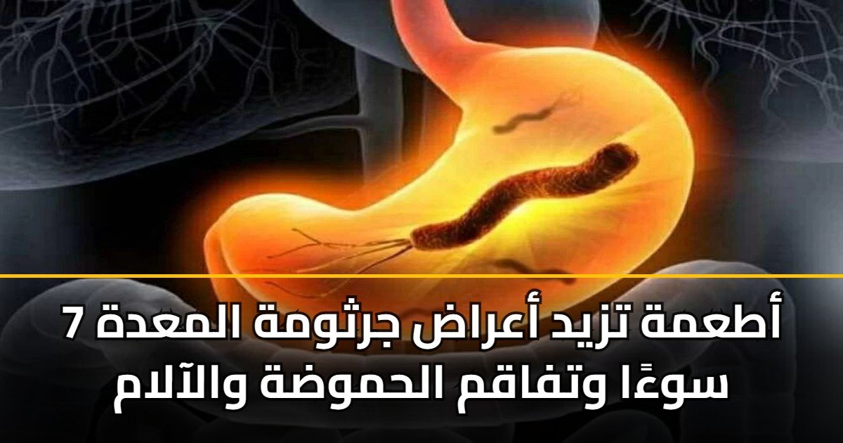 7 أطعمة تزيد أعراض جرثومة المعدة سوءًا وتفاقم الحموضة والآلام