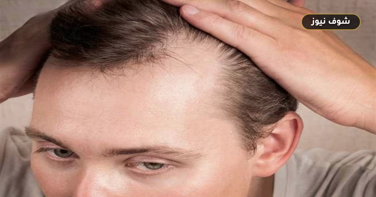 وصفات طبيعية لتساقط الشعر: حقيقة علاج الصلع و6 طرق معتمدة للعناية 5 وصفات طبيعية لتساقط الشعر: حقيقة علاج الصلع و6 طرق معتمدة للعناية