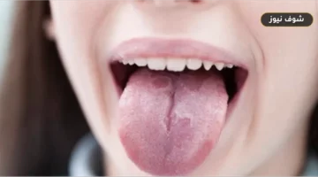 تغيرات اللسان والفم: دلالات صحية تبدأ من نقص الفيتامينات وتصل إلى الفحص المبكر